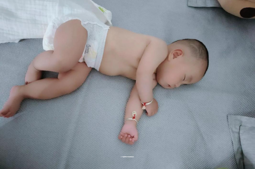岑溪六个月宝宝眼睛散光